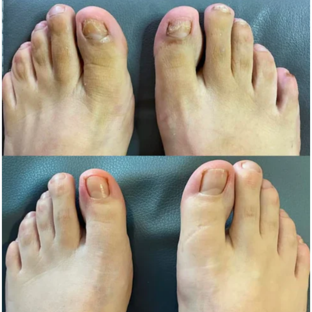 From “I Feel Dirty” to “I Feel Free” — Finally, Something That Works Without the Shame