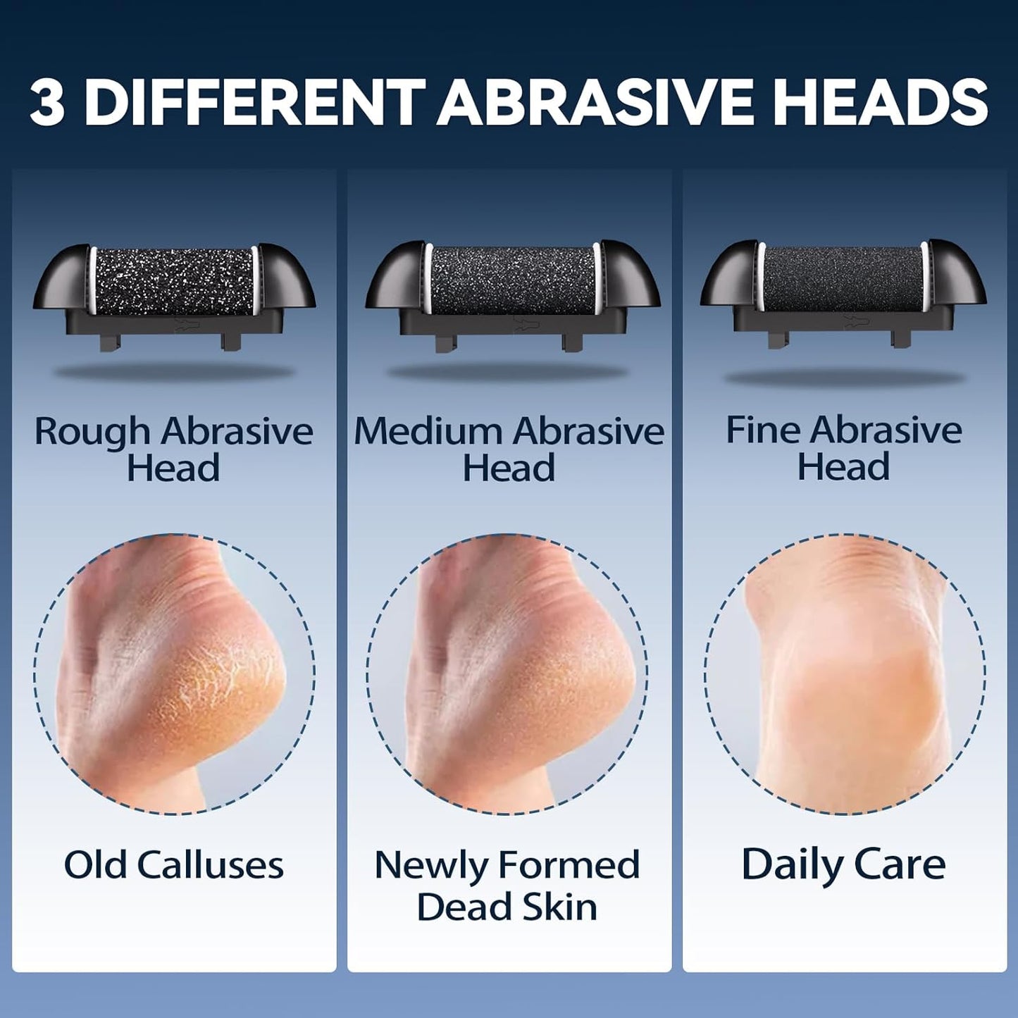 Salon-Soft Feet at Home — With Our Electric Callus Remover