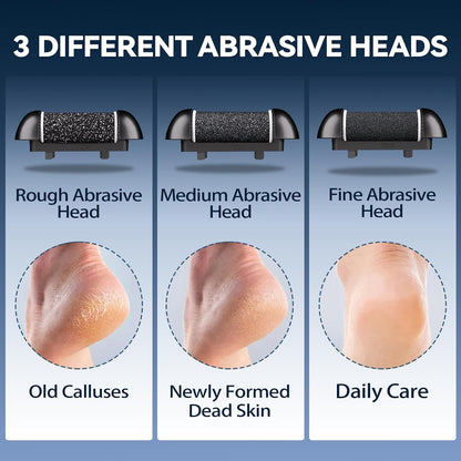 Salon-Soft Feet at Home — With Our Electric Callus Remover